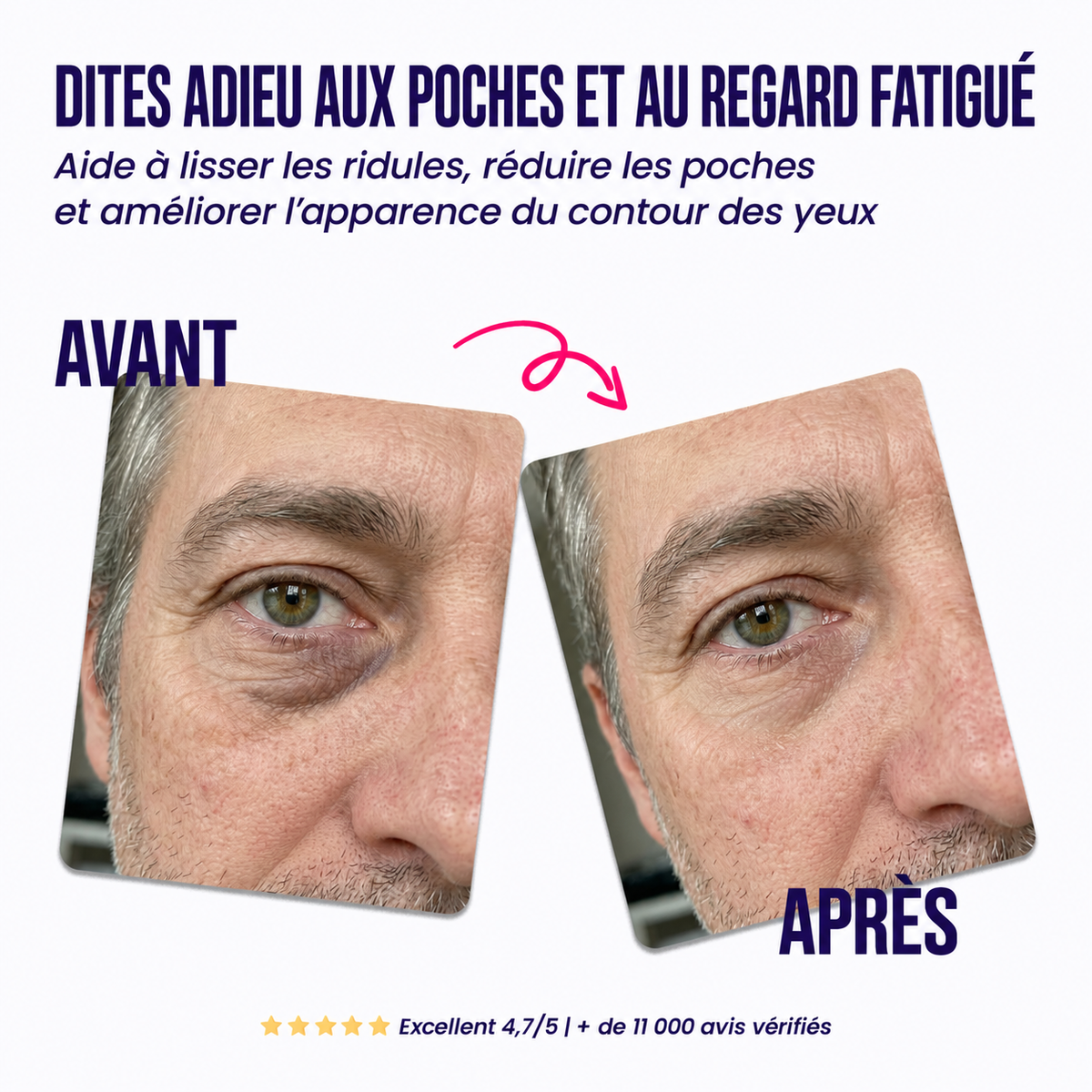 Patchs réparateurs pour le contour des yeux