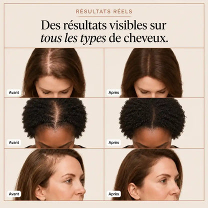 Sérum Capillaire  Saya